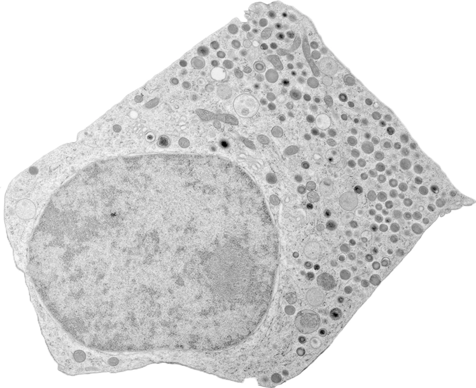 BetaCell_EM-Bild_transparent