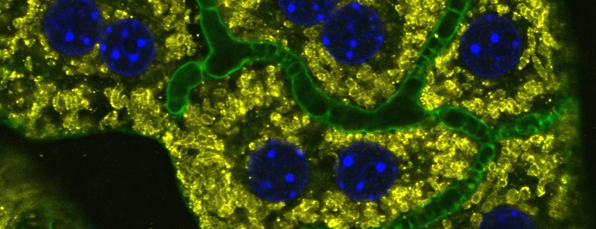 Endocytosis & Metabolism Group Image