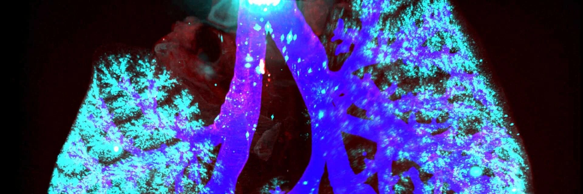 Aerosol distribution in lung LHI