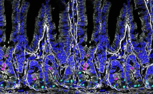 Cross-section of the intestine of a mouse