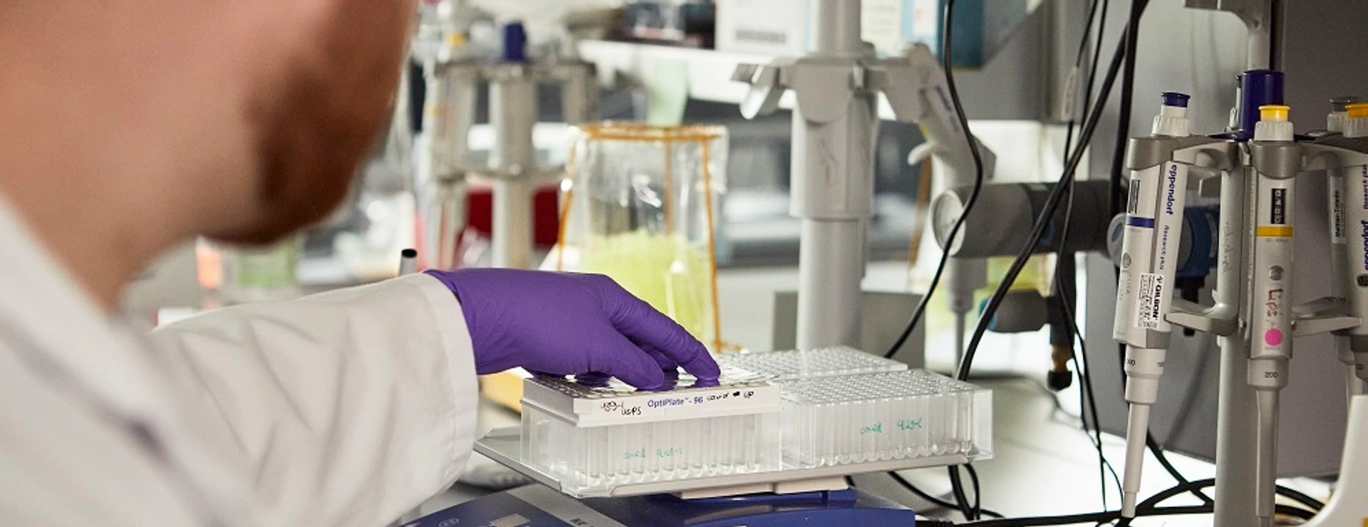IDF Labor, Typ-1-Diabetes Forschung