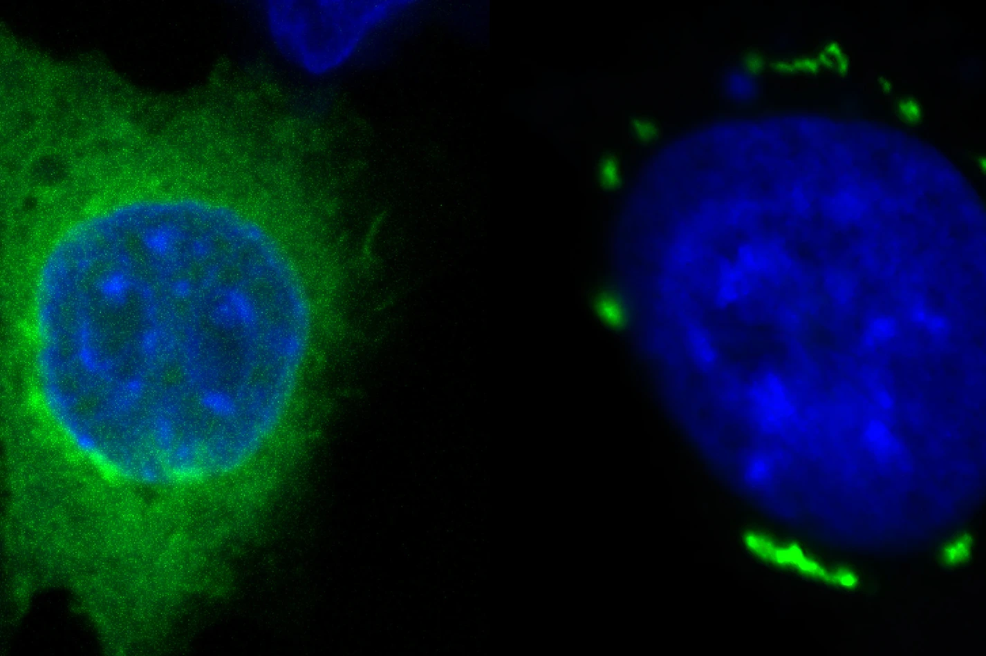 FSP1 condensates in green induced by icFSP1 surrounding a blue nucleus