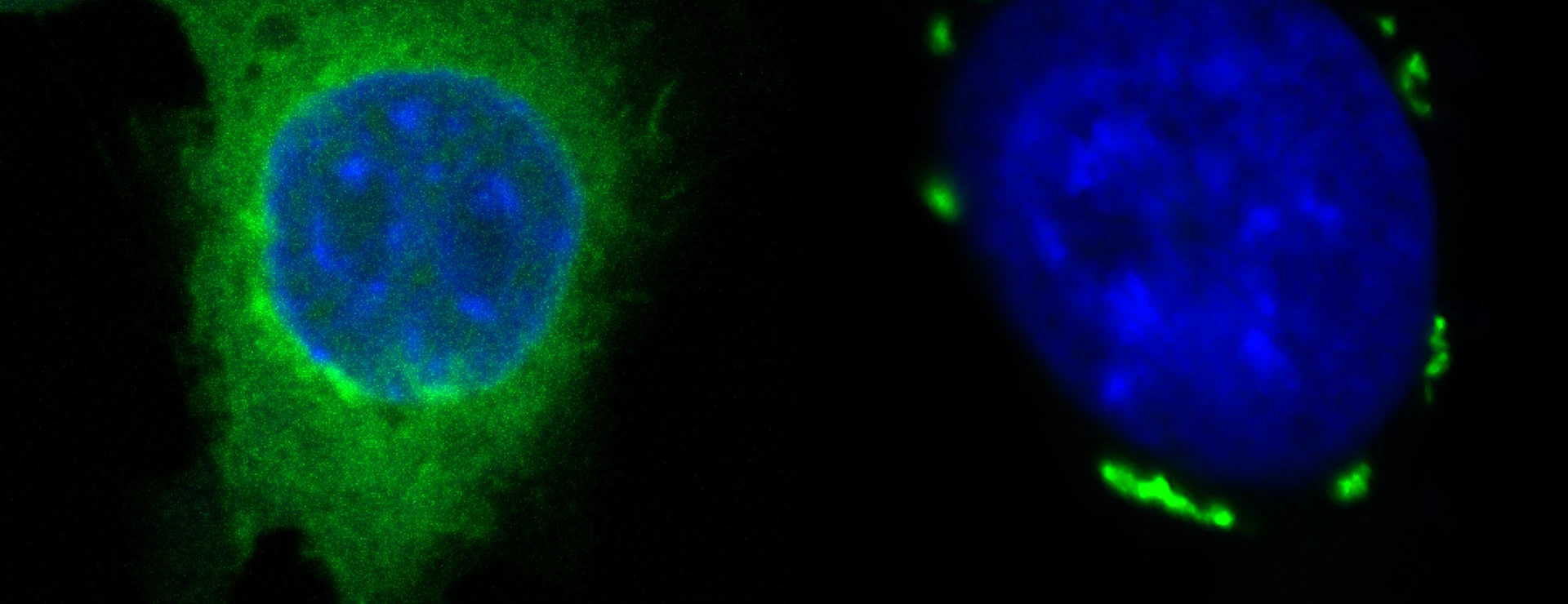 FSP1 condensates in green induced by icFSP1 surrounding a blue nucleus