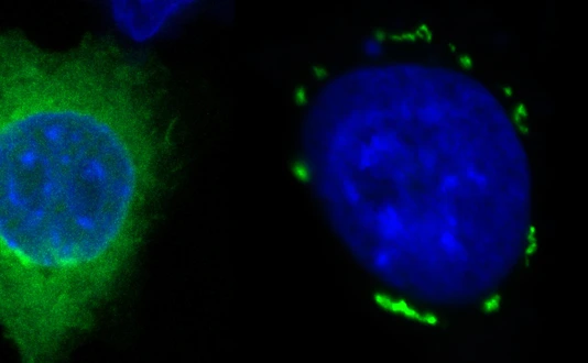 FSP1 condensates in green induced by icFSP1 surrounding a blue nucleus