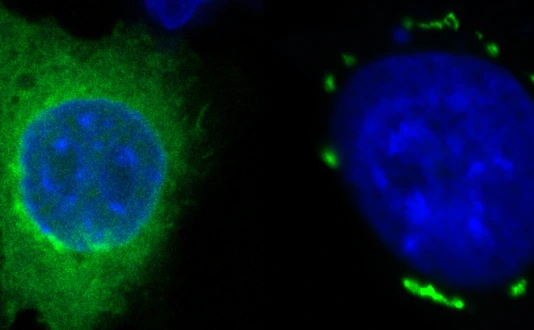 FSP1 condensates in green induced by icFSP1 surrounding a blue nucleus