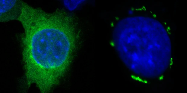 FSP1 condensates in green induced by icFSP1 surrounding a blue nucleus
