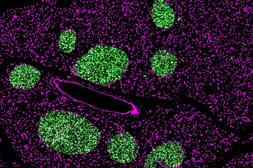 Bauchspeicheldrüse einer erwachsenen Maus nach chronischem Intervallfasten