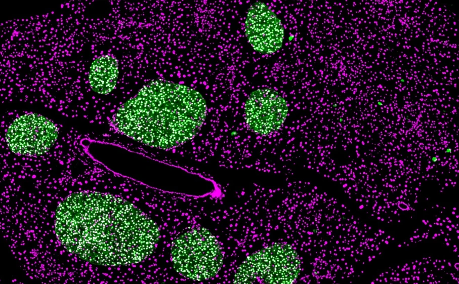 Bauchspeicheldrüse einer erwachsenen Maus nach chronischem Intervallfasten
