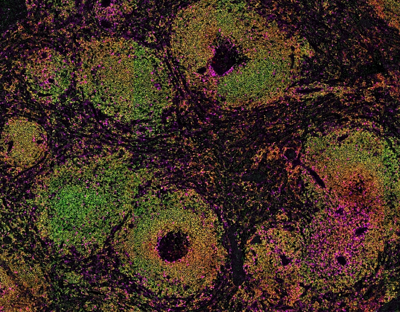 Rodriguez-Calvo_Spleen