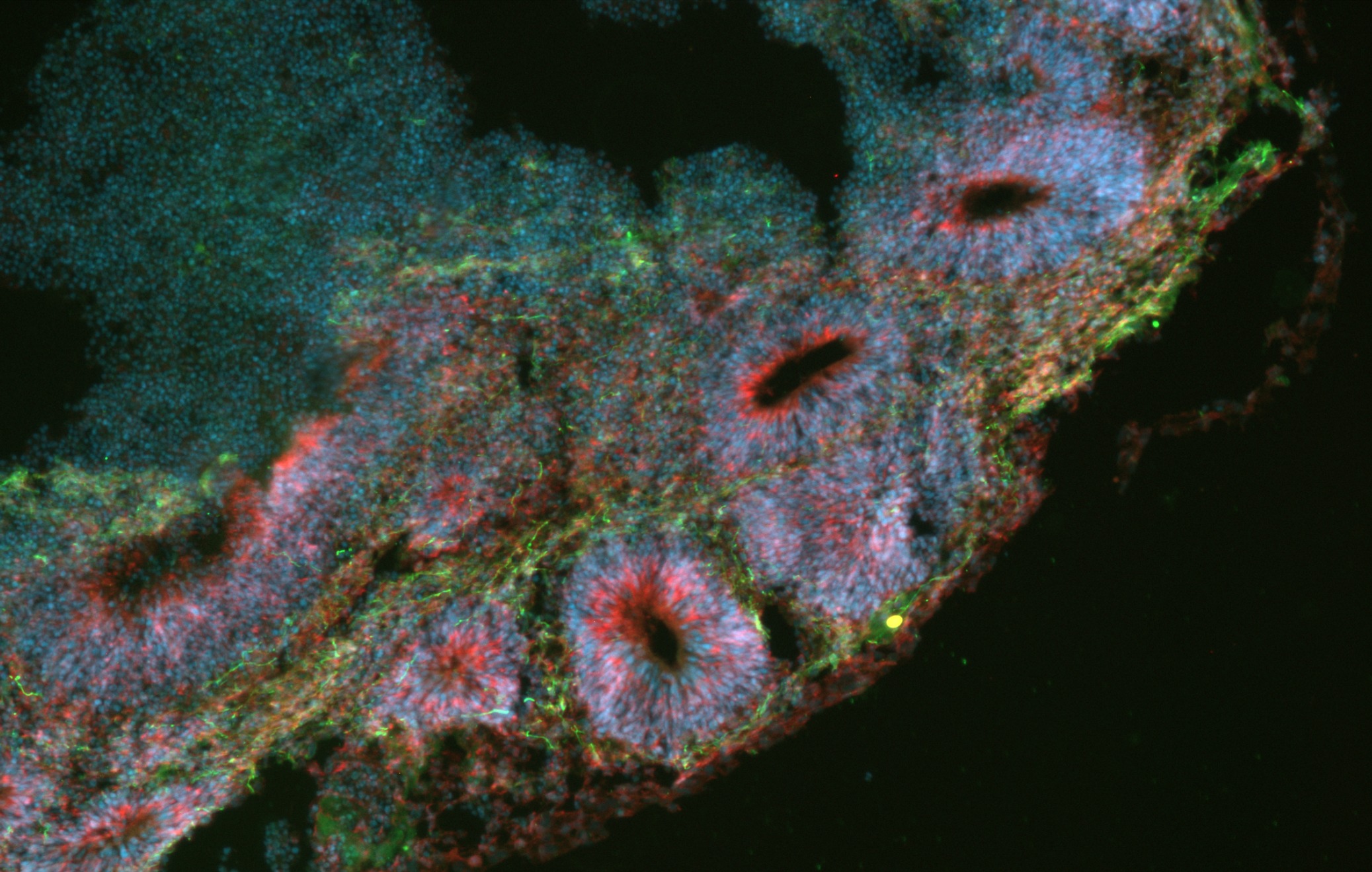 Organoid-tricolore
