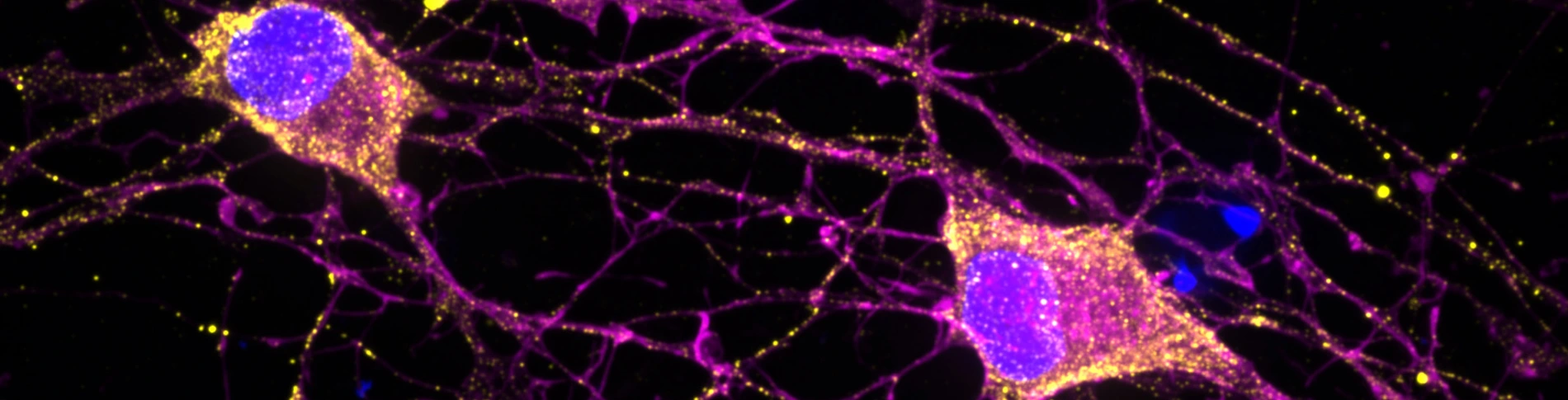 Header Apoorva Baluapuri lab