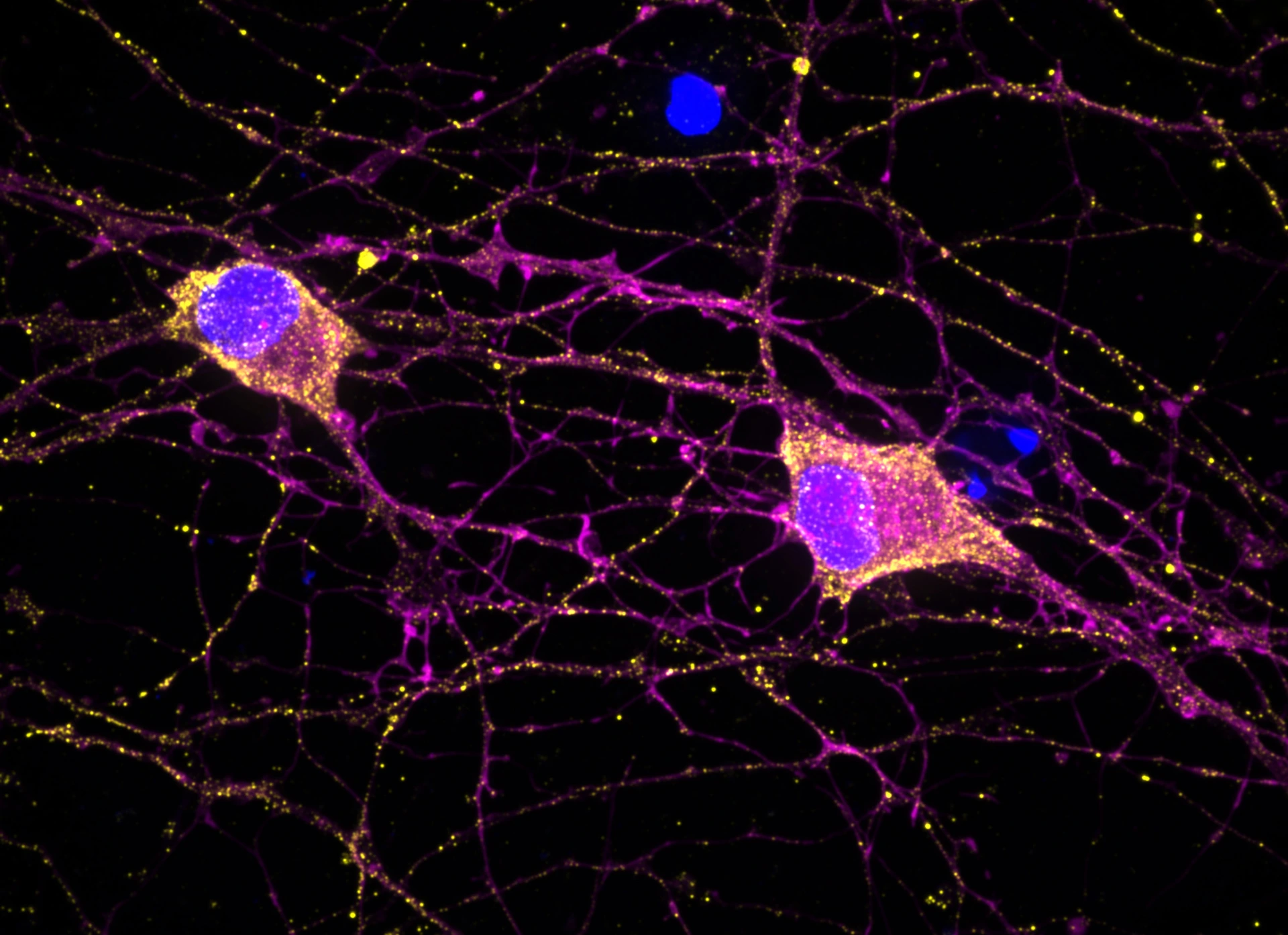 Header Apoorva Baluapuri lab