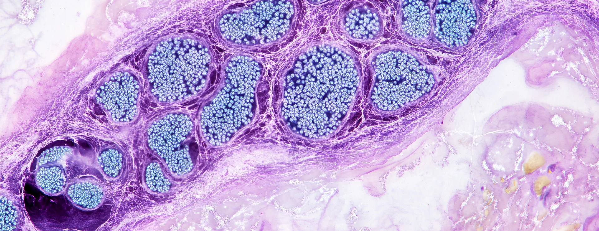 Pancreatic islets