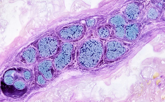 Pancreatic islets