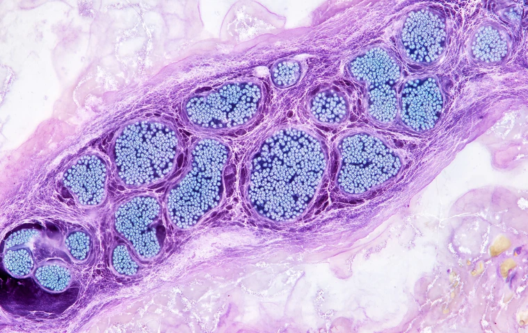 Pancreatic islets