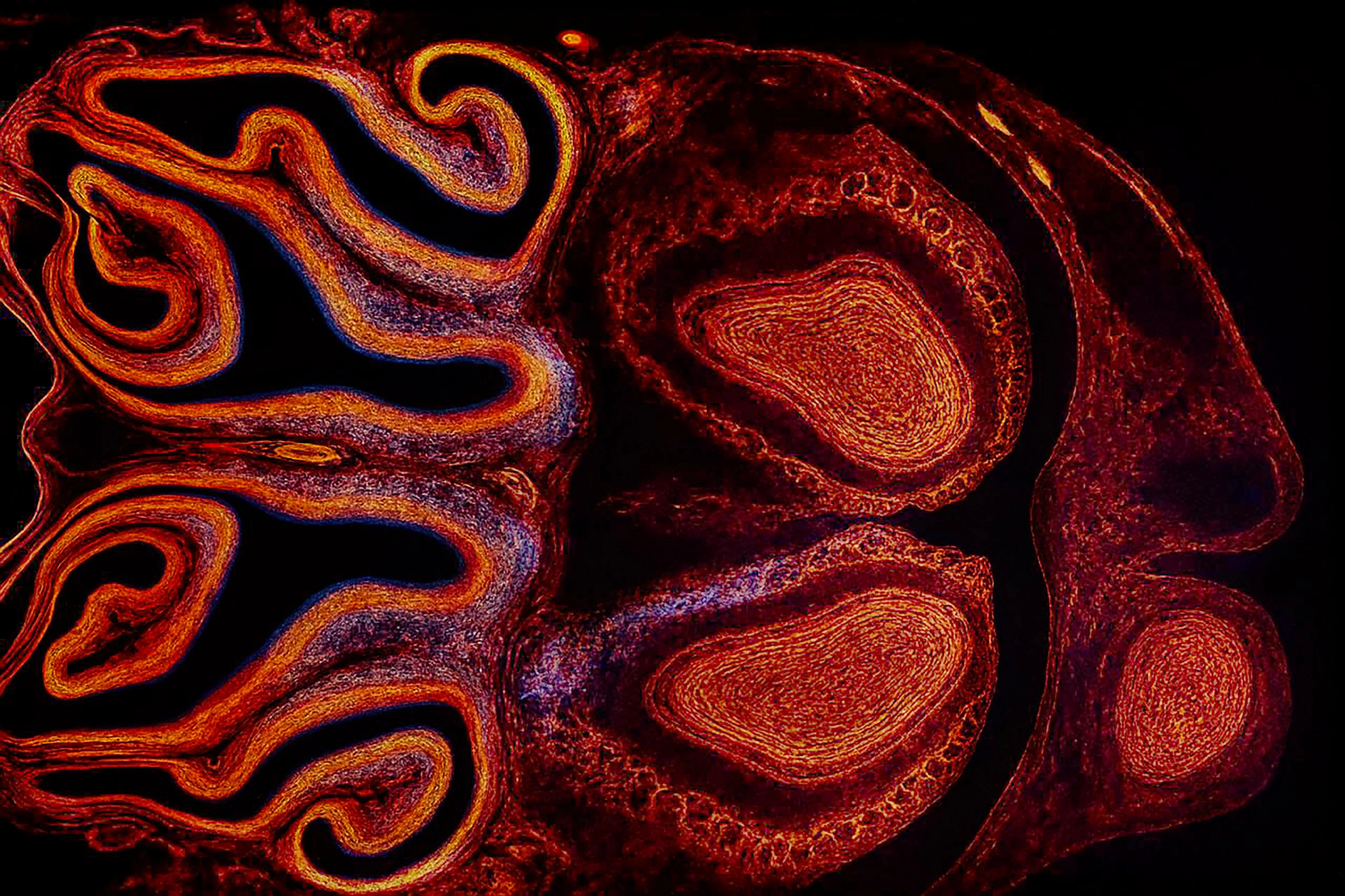 Microscopy of olfactory sensory mice neurons