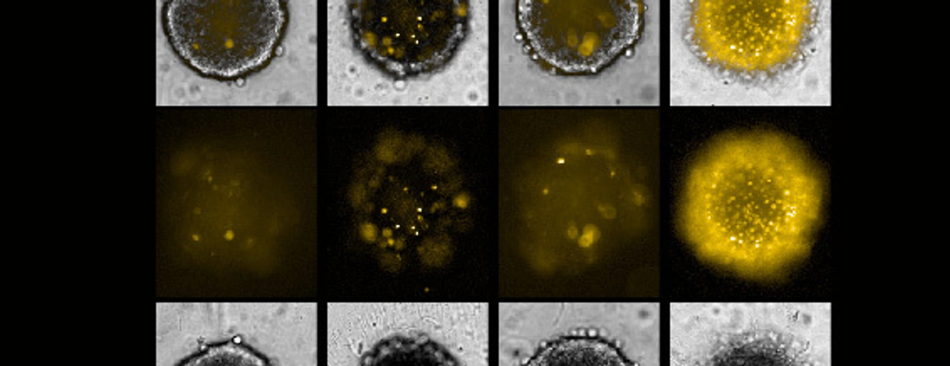 MS4A15 Fig 1 Ferroptose