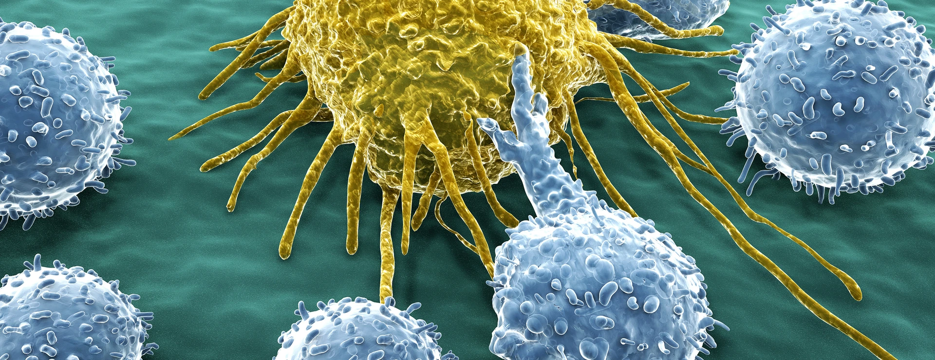 Krebszelle und Lymphozyten