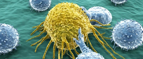 Krebszelle und Lymphozyten