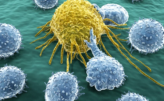Krebszelle und Lymphozyten