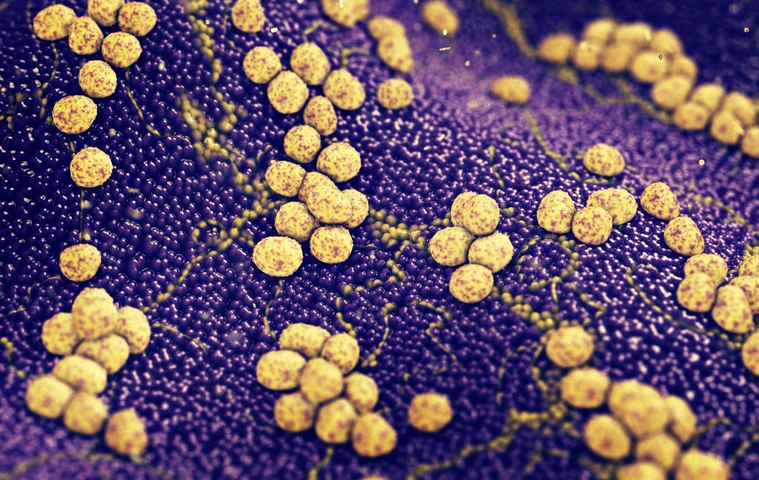 Antibiotic resistant infectious diseases
