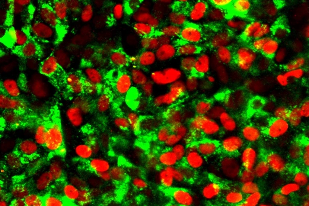 177 all staining expt 5