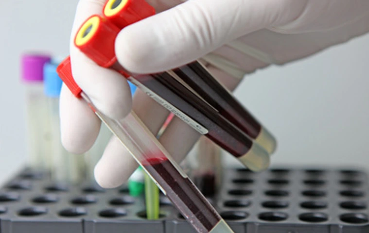 Scientist working at the laboratory - blood collection tubes