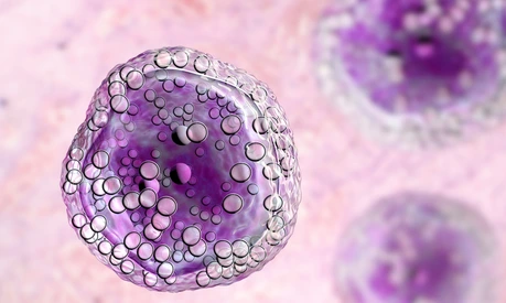 Burkitt's lymphoma cell, is a cancer of the lymphatic system