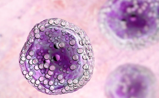 Burkitt's lymphoma cell, is a cancer of the lymphatic system