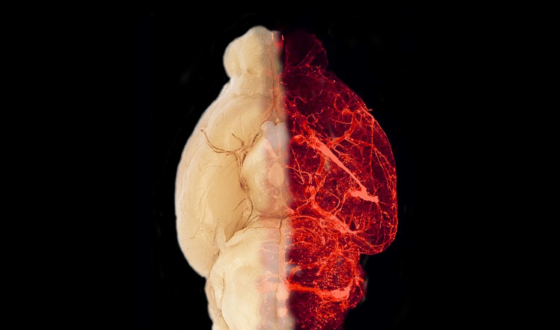 Blood vessels in the transparent brain of an obese mouse model