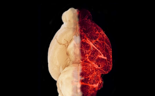Blood vessels in the transparent brain of an obese mouse model