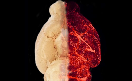 Blood vessels in the transparent brain of an obese mouse model