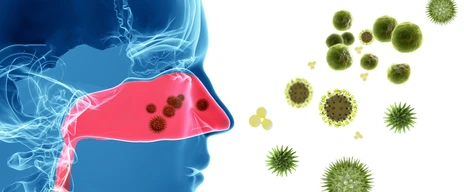 Lokale allergische Rhinitis