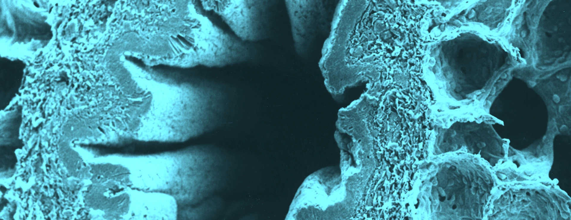 bronchiolus_querschnitt_helmholtz_1920x640px