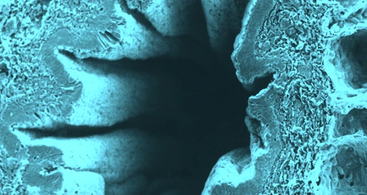 bronchiolus_querschnitt_helmholtz_1920x640px