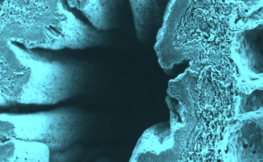 bronchiolus_querschnitt_helmholtz_1920x640px