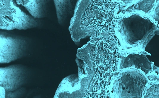 bronchiolus_querschnitt_helmholtz_1920x640px