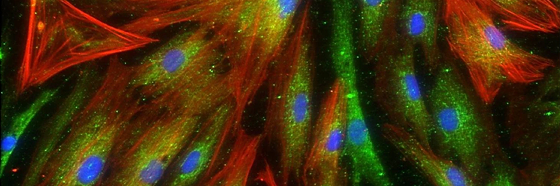 Lung fibroblasts under microscope