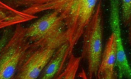 LHI-staab-weijnitz-lungenfibroblasten