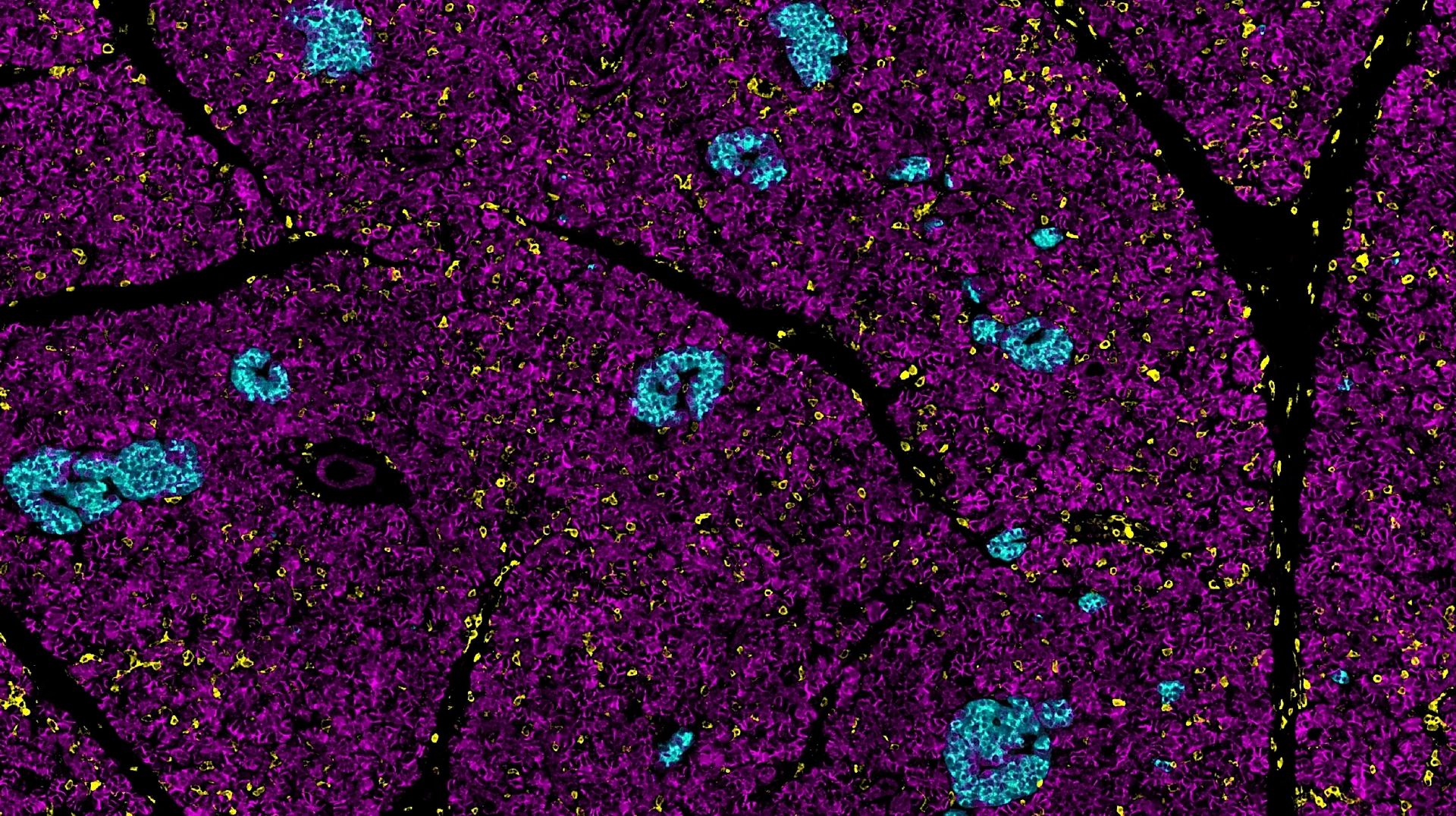 Rodriguez-Calvo_Pancreas