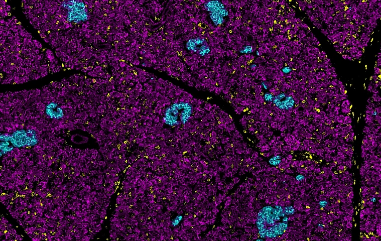 Rodriguez-Calvo_Pancreas