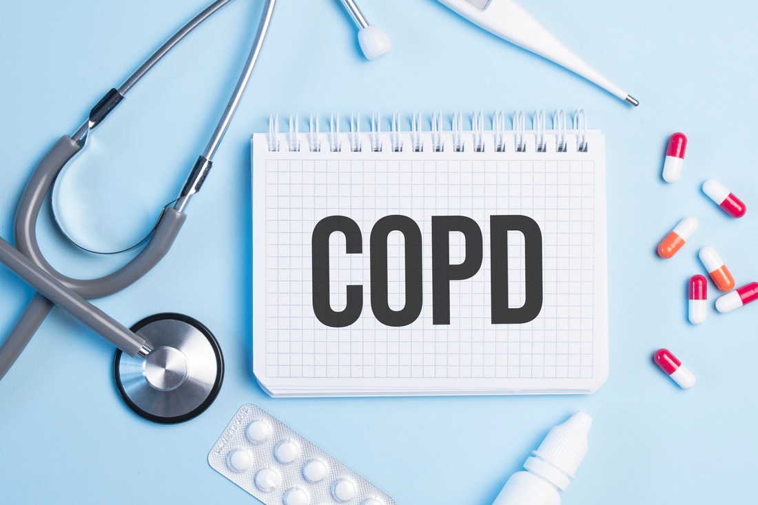 The word copd written on a white notepad on a blue background near a stethoscope, syringe, electronic thermometer and pills. Medical concept