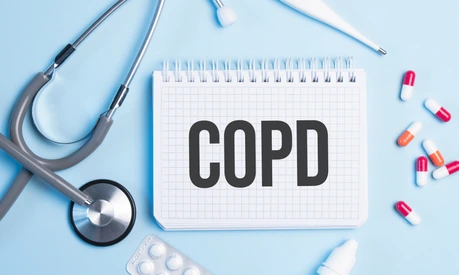 The word copd written on a white notepad on a blue background near a stethoscope, syringe, electronic thermometer and pills. Medical concept