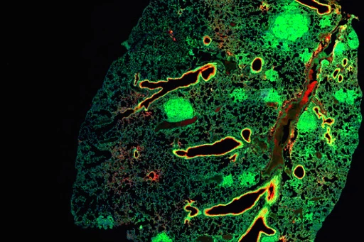 [Translate to German:] 