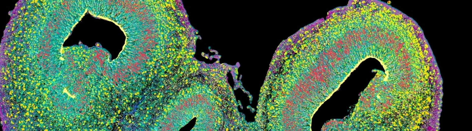 Brain organoid