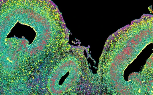  Microscopic image of a brain organoid, cross section.