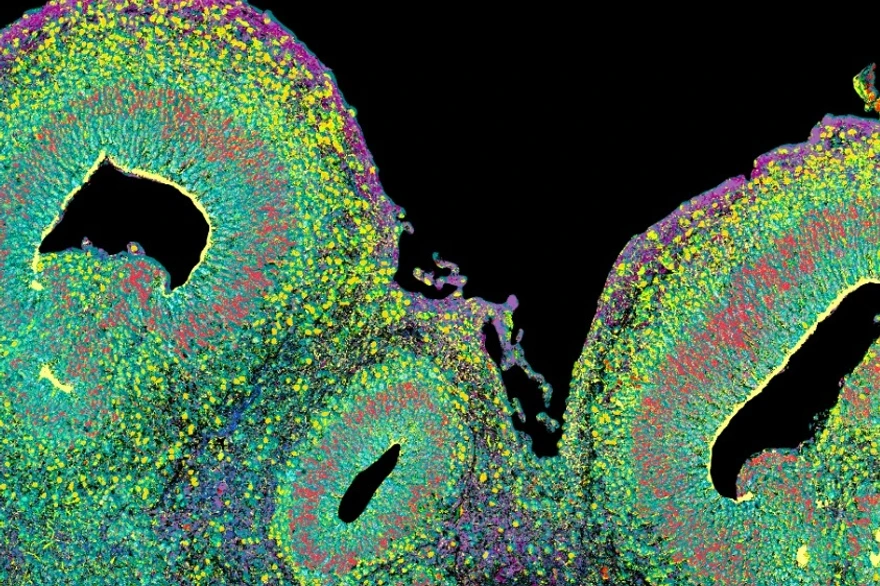 Microscopic image of a brain organoid, cross section.