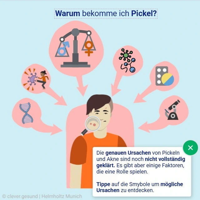 Screenshot-Genially-Akne