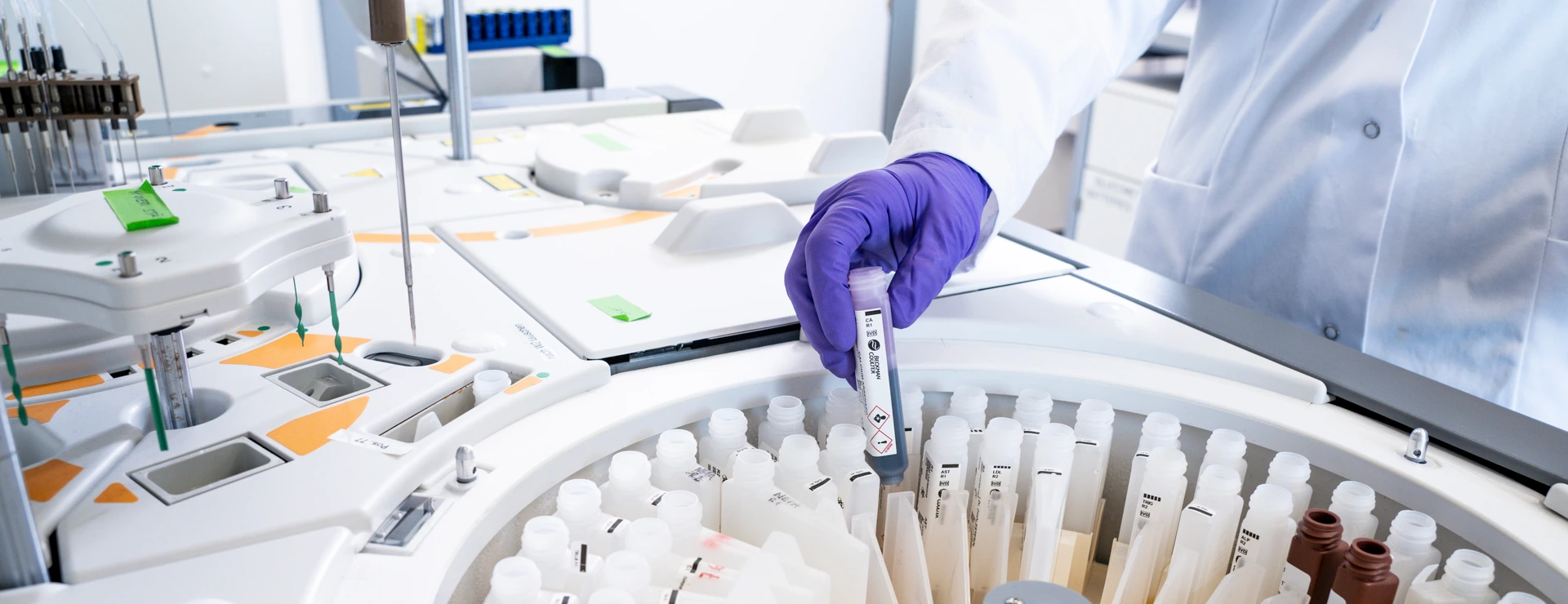 IDC Labor, Serum Analyzer, Befüllung mit Testreagenzien