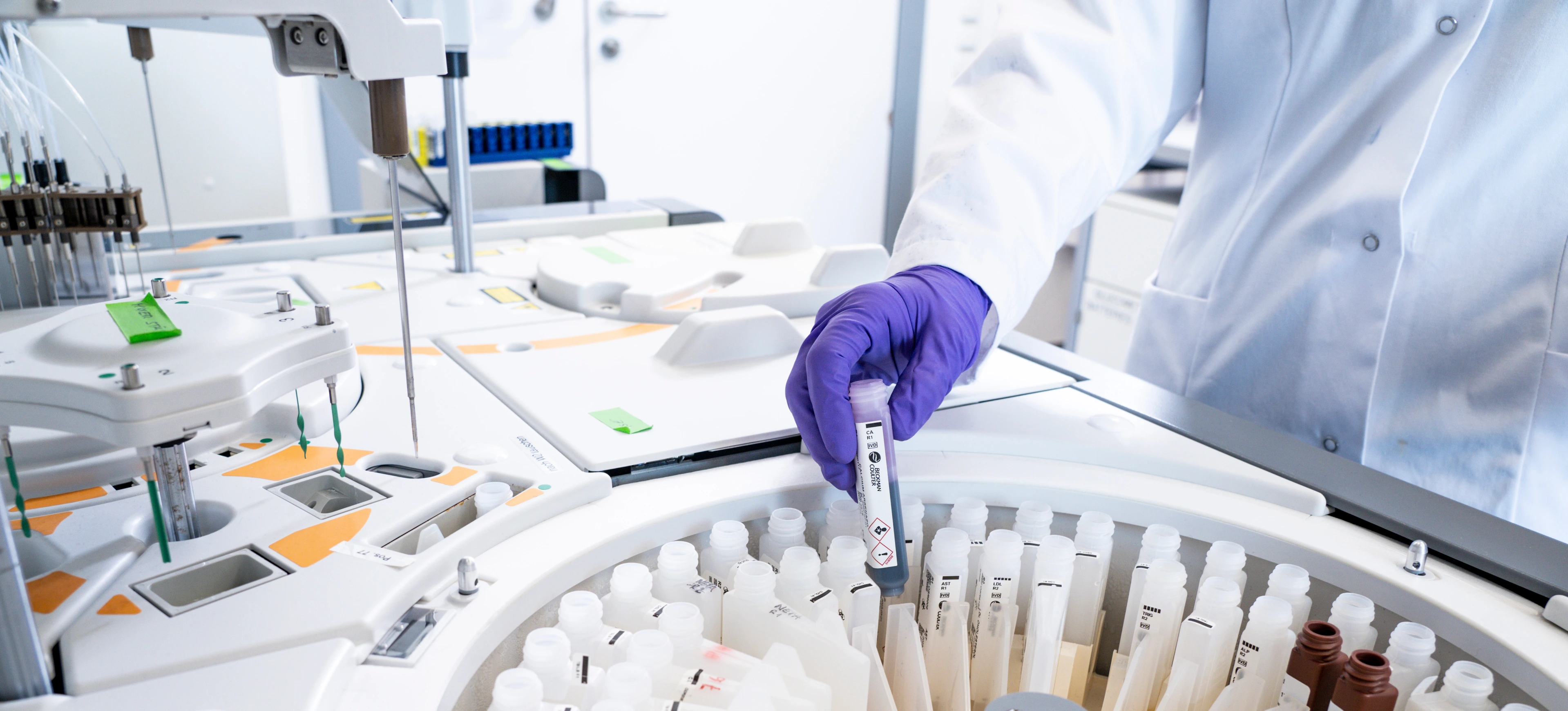 IDC Labor, Serum Analyzer, Befüllung mit Testreagenzien